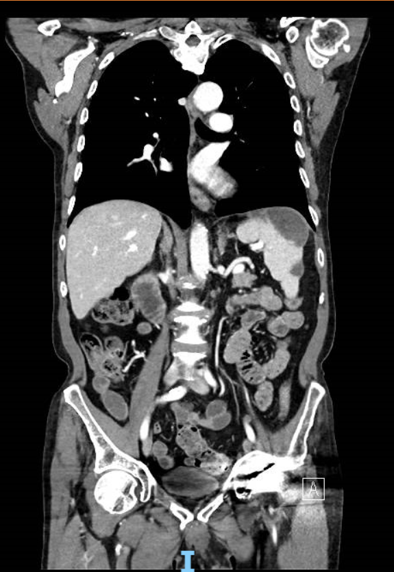 BSG-Endoscopy-Case-Series-5.png