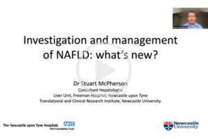 Masterclass-video-investigation-management-nafld.png