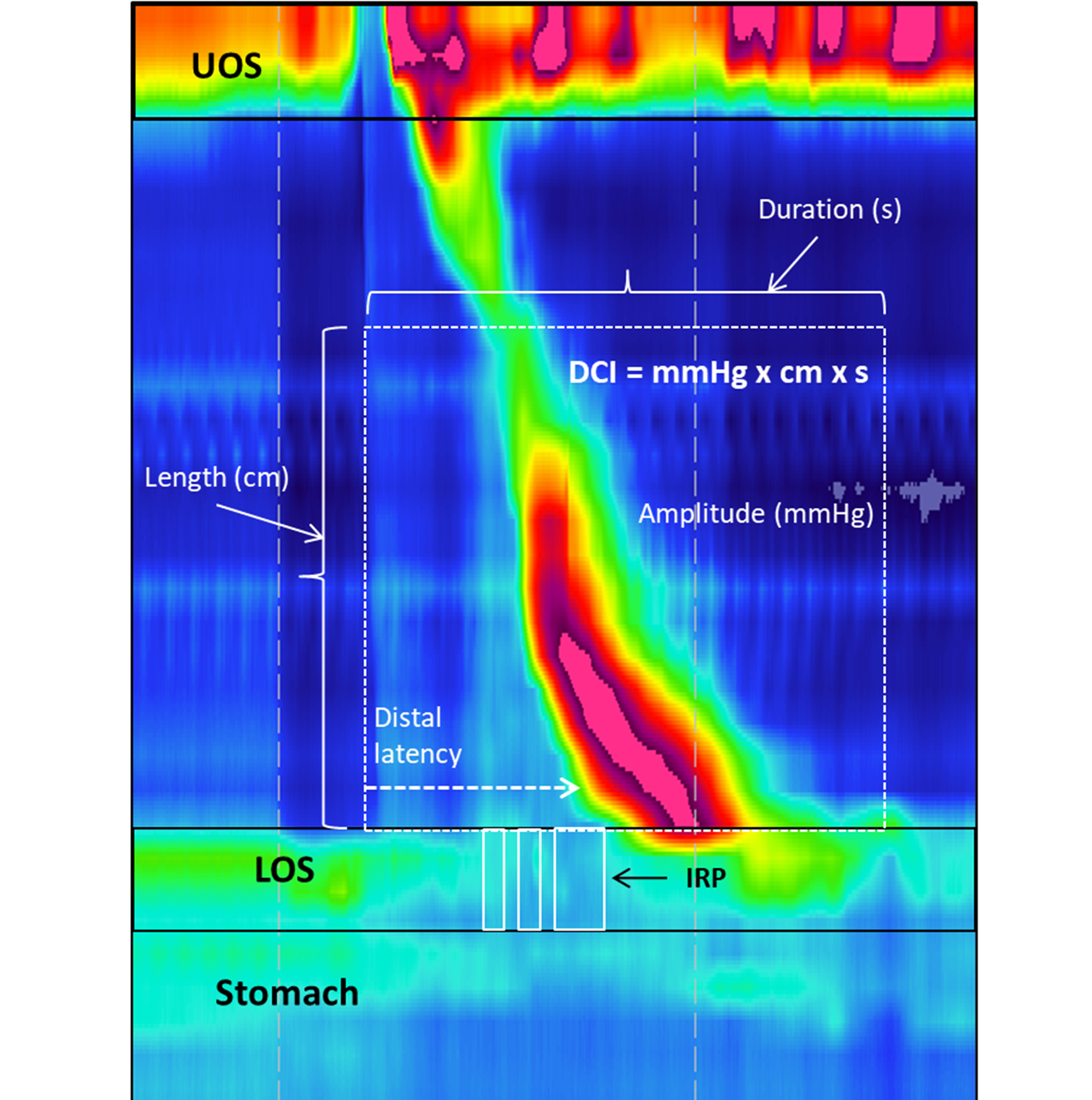 Disorders-of-Oesophageal-Motility-image.png