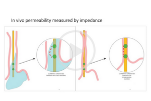 masterclass-video-images-Baseline-Impedance-Explained.png